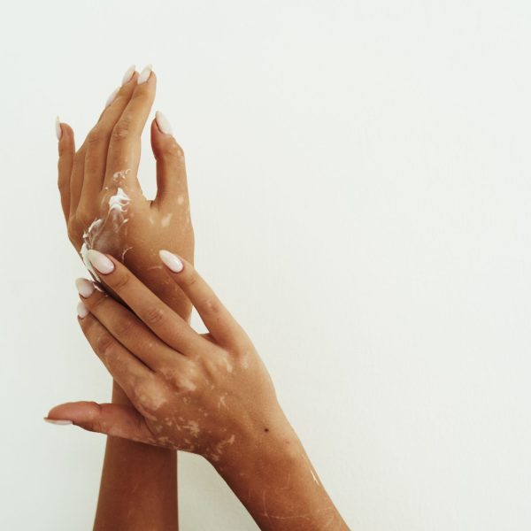 Young woman distributes hand cream on her hands. The concept of skin hydration, hand care and wrinkle prevention.